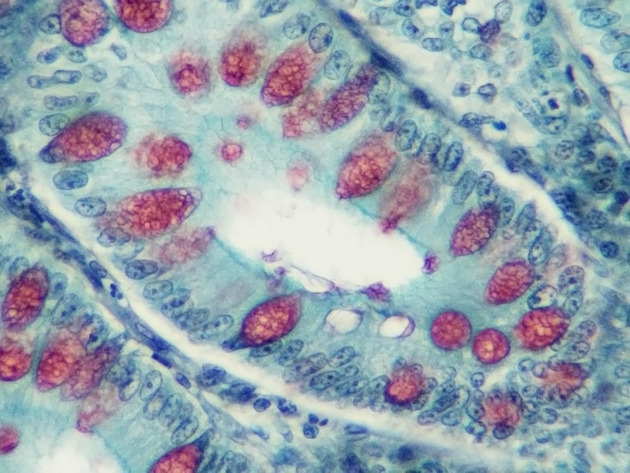 Simple Columnar Epithelium Slides - Simple Columnar Epithelium 19 400X